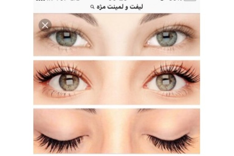 کانون زیبایی