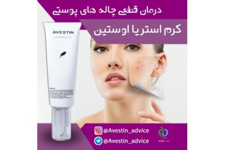 کرم استریا اوستین