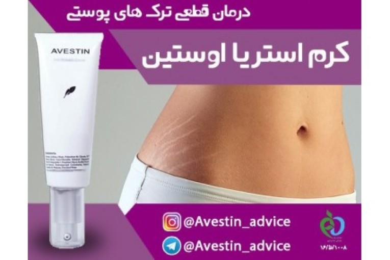 کرم استریا اوستین