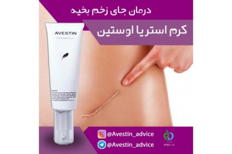 کرم استریا اوستین